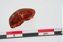 Foto von Bernsteinring (NHMW-PRAE-024218)